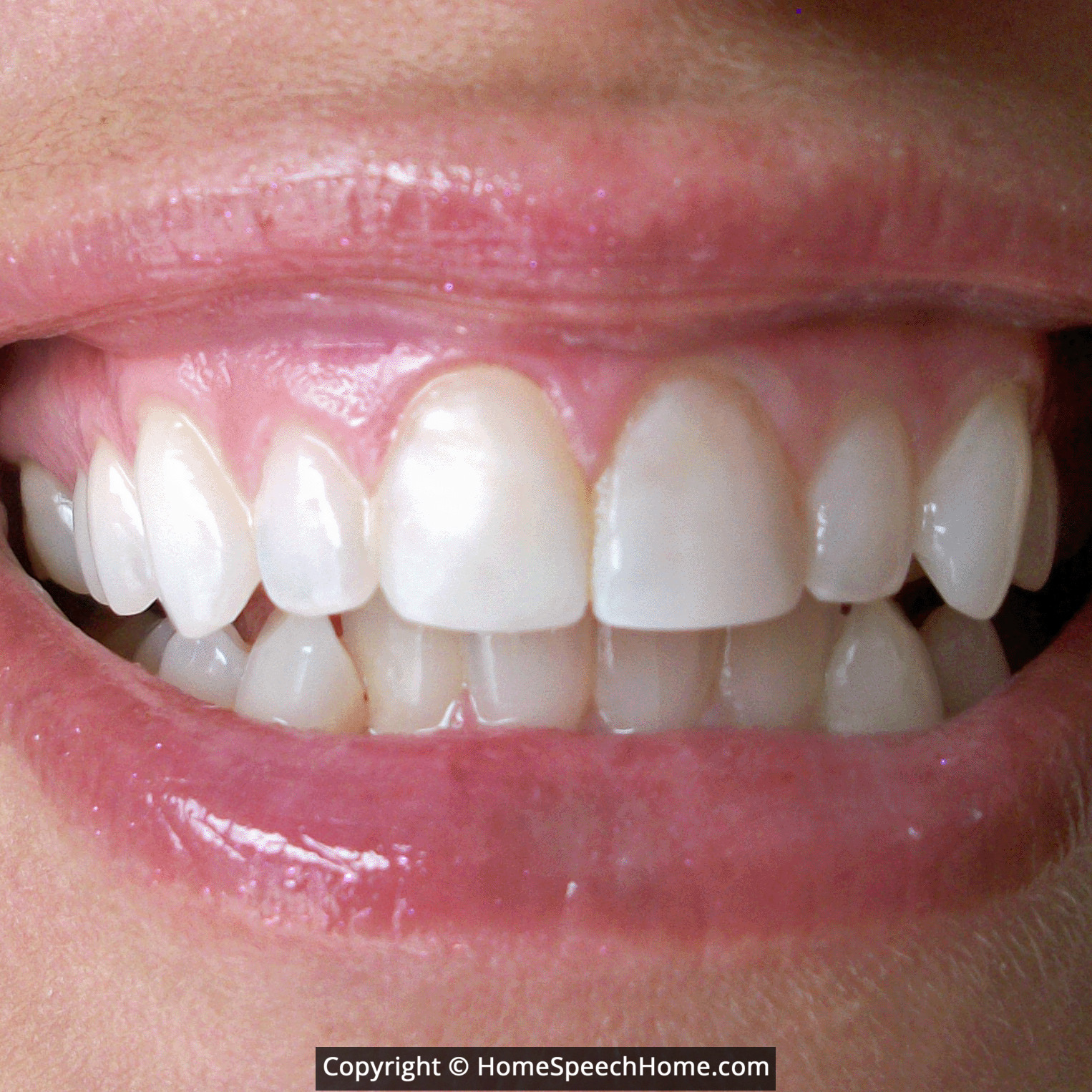 Voiceless TH Word Flashcard Perfect for Speech Therapy Practice