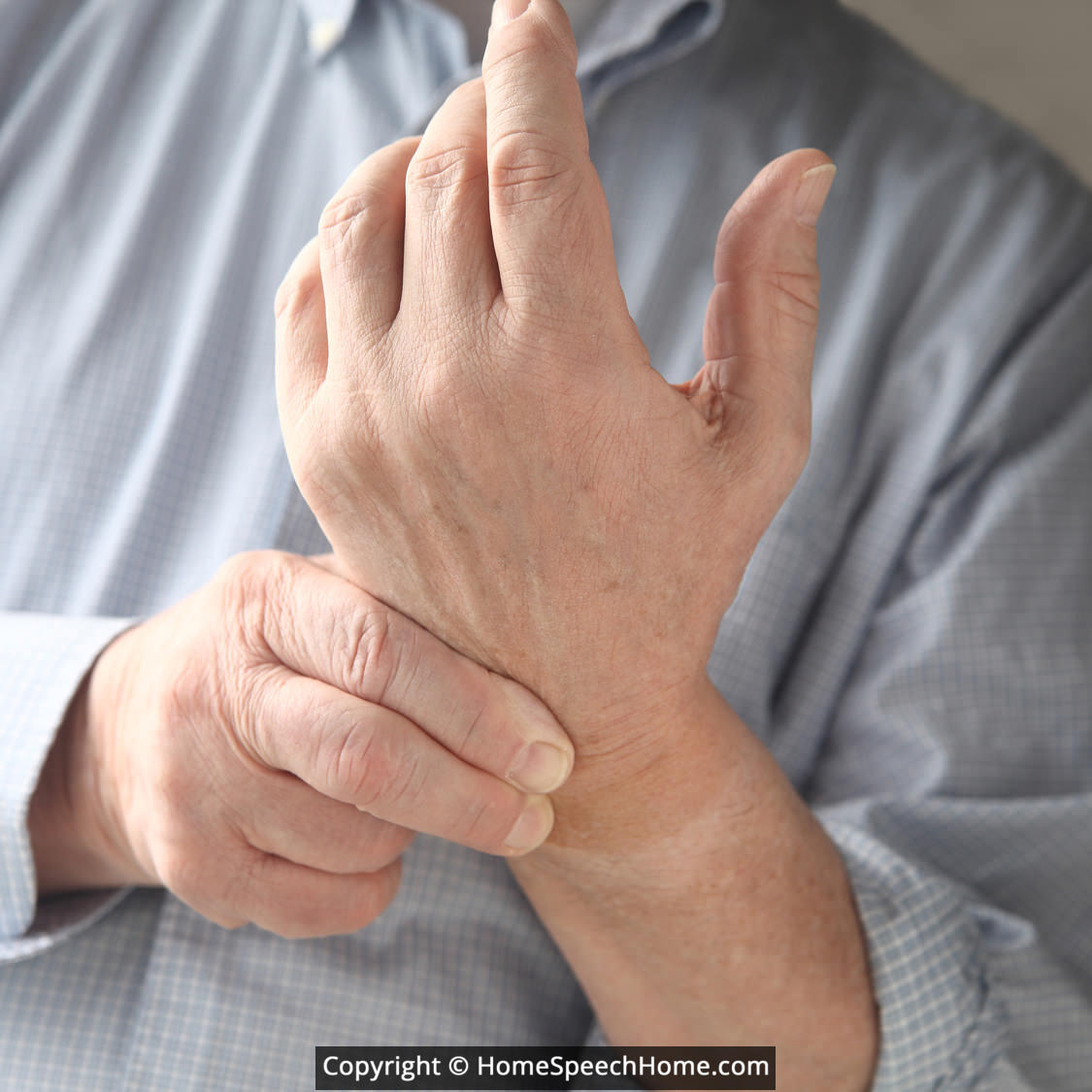 Отеки рук болят суставы. Гипертония кисти рук. Фиброматоз ладони фото.